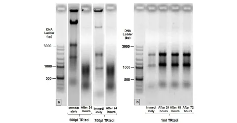 Figure 3.  Analysis of extracted RNA for integrity and its solution in DEPC-treated water