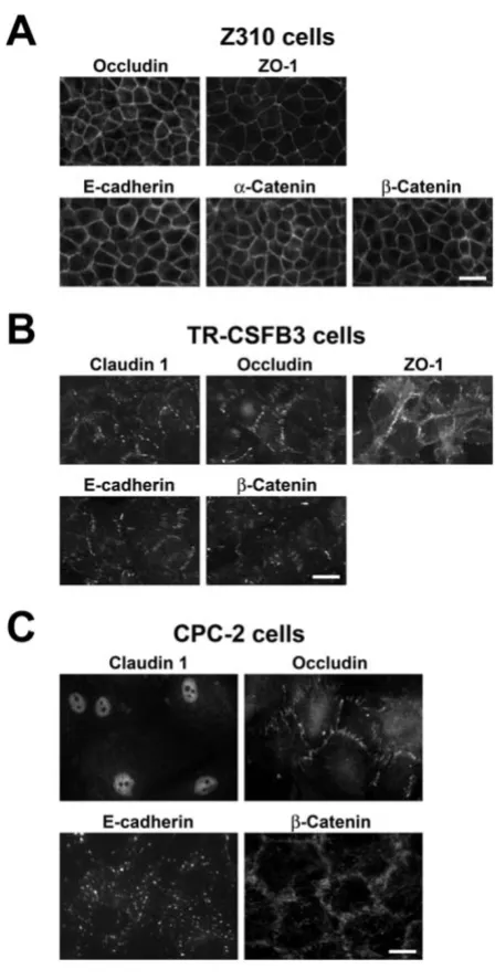 Figure 4proteins in CP cell linesImmunocytochemical analysis of expression of junctional Immunocytochemical analysis of expression of junctional proteins in CP cell lines