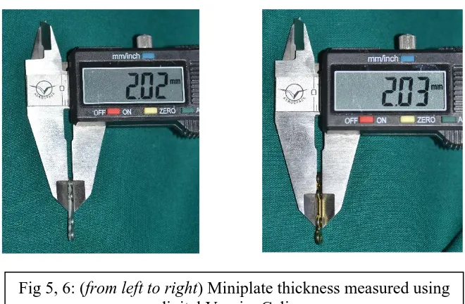 Fig 4A – Synthes Locking plate, 4B – Orthomax conventional plate, 