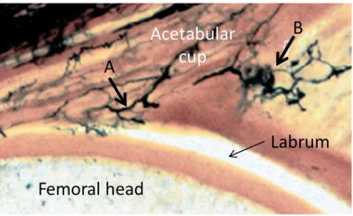 Figure 1-13 The blood supply to the acetabular labrum. The blood supply to the labrum  from the joint capsule (A) and the bony acetabulum (B), taken from Kelly et al