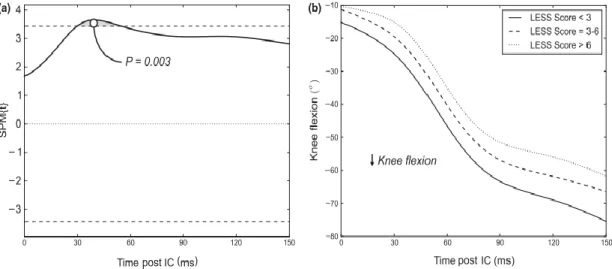Figure 2.9.  Descriptive and Inferential SPM Curves Describing the Relationship between  Less Scores and Knee Flexion during a Functional Task (Fox, Bonacci, McLean, &amp; 