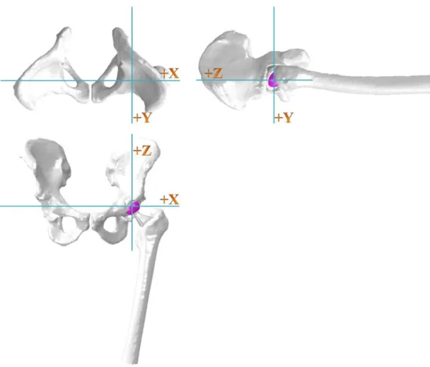 Figure 2.1:  FE representation of THA construct in pelvis and femur 