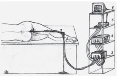 Fig 5: Anal manometry with electro transducer 