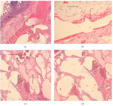 Figure 3: Histology images of the reported small bowel hamartoma. (a) Normal small intestinal mucosa top arrow and dilated thin-walledvascular spaces in the muscularis propria bottom arrow