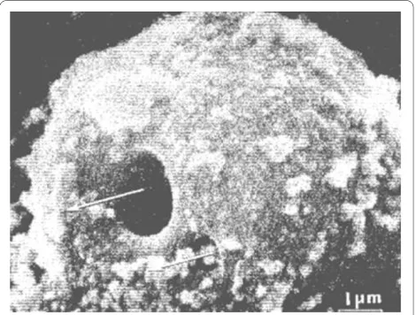 Figure 6 Electron micrograph of the mesothelial cells lining the arachnoid villus showing empty giant vacuole (V)