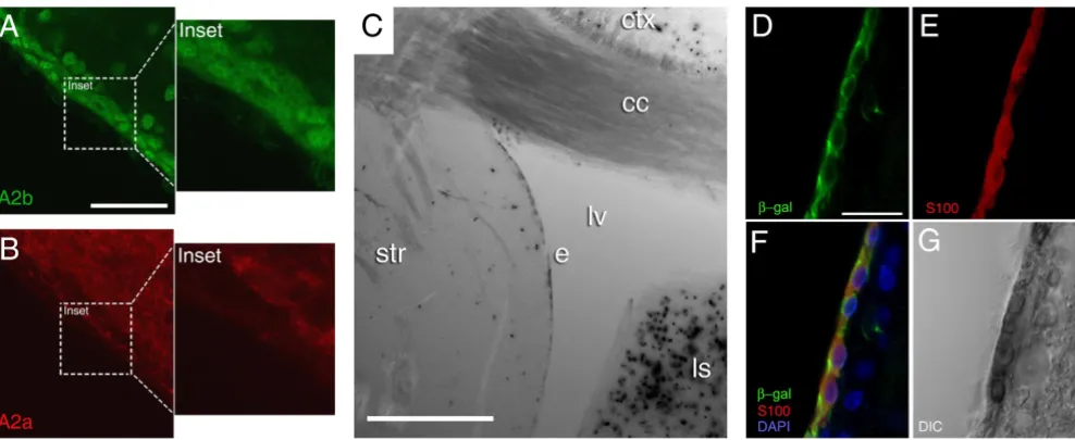 Fig. 1C, Fig. 2C, and Fig. 4B argue that a minor P2X77-mediated component to BzATP-induced ciliary beat fre-
