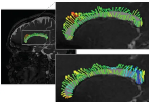 Figure 3DPIV volume change estimation techniqueDPIV volume change estimation technique