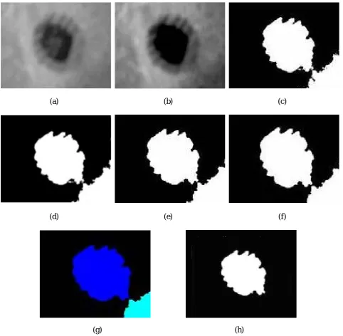 Figure 2. (a) The original image, (b) the improved image contrast, (c) the threshold operation, (d) the image after filling the holes, (e) separating image areas, (f) the image after opening, (g) the image after labeling  and (h) selecting the spot on the 
