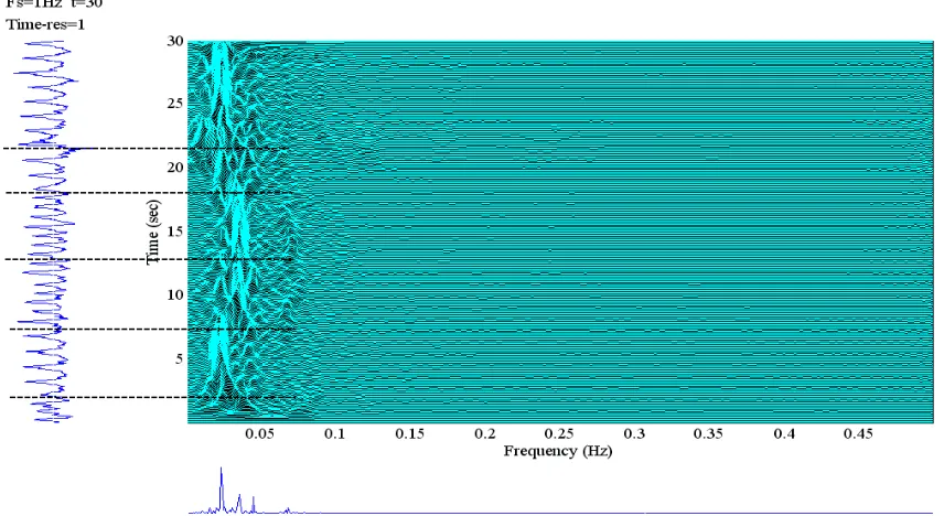 Figure 6. Using the proposed method for segmenting EEG signal, (a) original signal, (b) approximate signal after applying five levels DWT, (c) fractal dimension computed using optimal window length (window length= 2.8 second) and overlapping is 50 % and (d