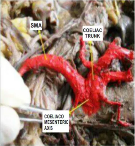 Fig. 5  Common Coeliaco – mesenteric Trunk 