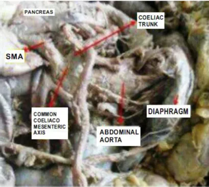 Fig.  6  Coeliac Trunk & Superior Mesenteric Artery                                 