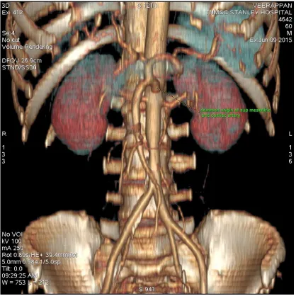 Fig. 7 Common origin of Superior Mesernteric Artery and Inferior 