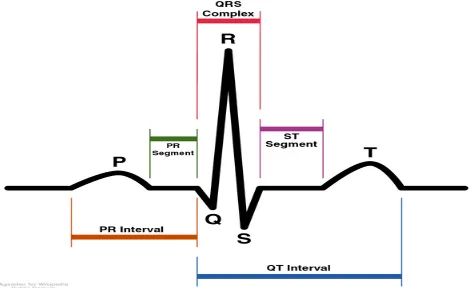 Figure 2.5: Schematic diagram of normal sinus rhythm for a human heart asseen on ECG [6]