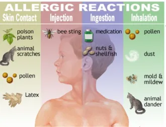 Fig 5. Causes of Allergic 