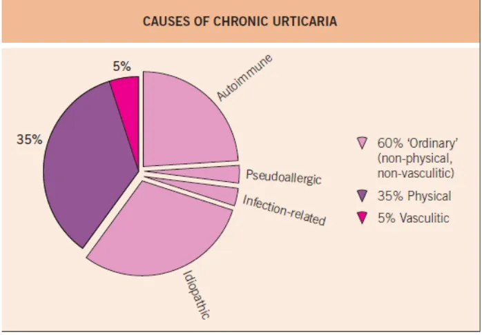 Fig 6. Distribution of causative factors for chronic urticaria