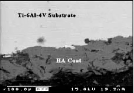 Figure 4. The surface morphology of plasma sprayed hydroxyapatite coating on Ti-6Al-4V