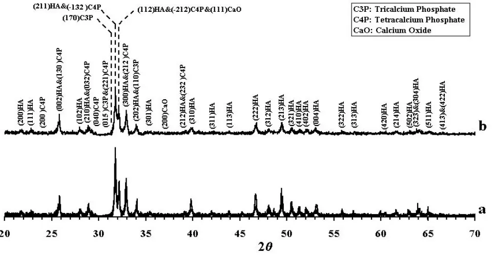 Figure 7. Typical FTIR spectra of the hydroxyapatite feed powder (a) and plasma sprayed hydroxyapatite coating (b)