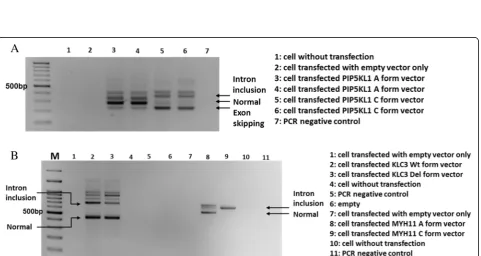 Fig. 2 CYP2C19CYP2C19 alternative splicing forms in minigene-transfected 293T and in EBV-transformed B cells carrying different genotypes at SNPrs12769205