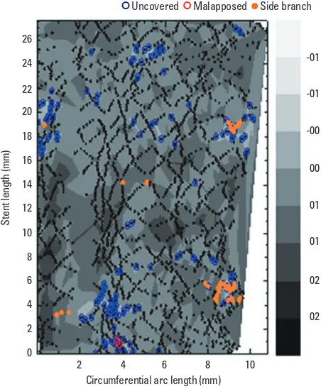 Fig. 4. Contour plot of strut coverage after drug-eluting stent implantation, using optical coherence tomography