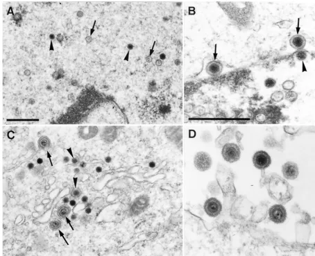 FIG. 7. Electron microscopy of PrV-�10 h after infection. Panel A shows the presence of intranuclear empty (arrows) and DNA-ﬁlled (arrowheads) nucleocapsids