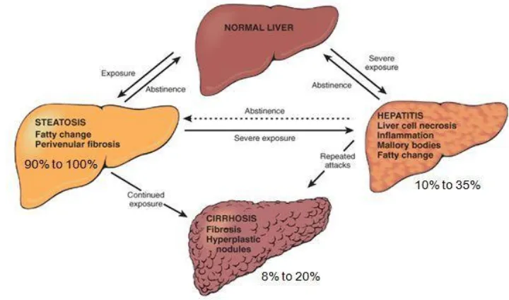 Figure: 7  Histopathology of Fatty Liver 