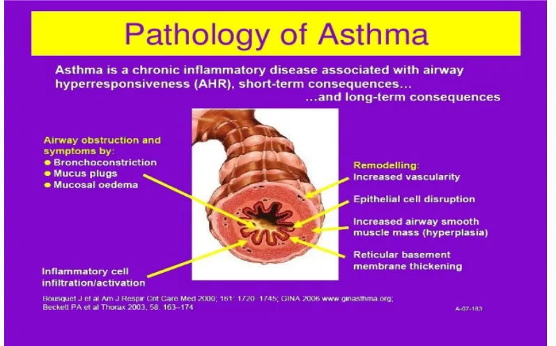Figure 5: Pathology Of Asthma. 