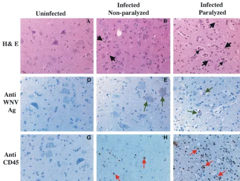 TABLE 1. Leukocyte inﬁltration and neuronal injury in thespinal corda