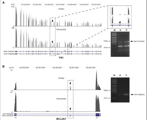 Fig. 2 Differential alternative splicing of FN1 and BCL2A1. a In the left panel, a read distribution plot for FN1 with differential isoform expressiondue to the inclusion of EDB domain in periodontitis tissues was shown