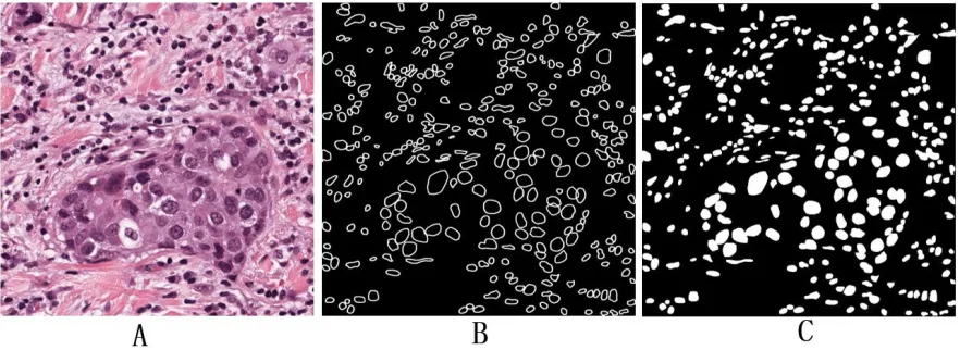 Figure 1. Pathological slides training set processing. 