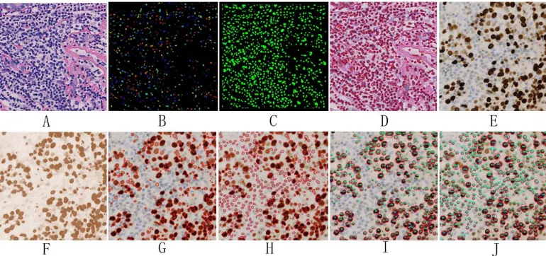 Figure 2. The segmentation results of pathological slides.  