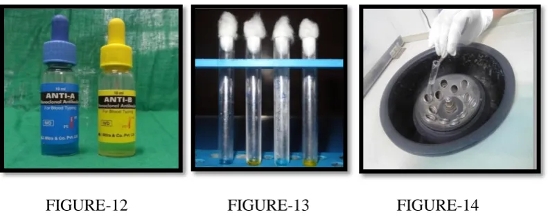 FIGURE 15,16,17-SHOWING ADDITION OF  BOVINE SERUM ALBUMIN, AND IT IS KEPT IN WATER BATH AT 560 C 