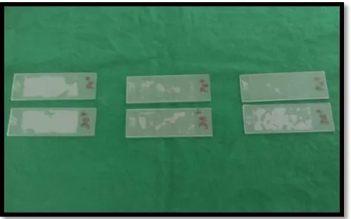 FIGURE 18 AND 19 SHOWING PREPARATION OF 0.5% RBC SUSPENSION 