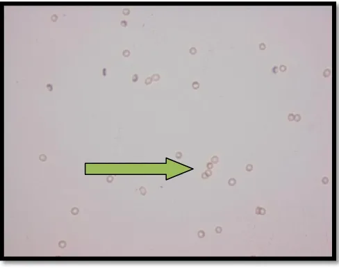 FIGURE 21-ARROW SHOWING AGGLUTINATION IN PULP 