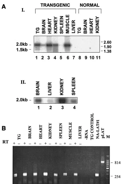 FIG. 2. Analysis of HSV-1 2.0- and 1.5-kb LATs in transgenic-mouse tissues. (A) Northern blot analysis