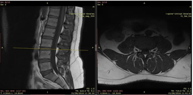 Figure 5.5 shows some examples of the selected images for each disc. 