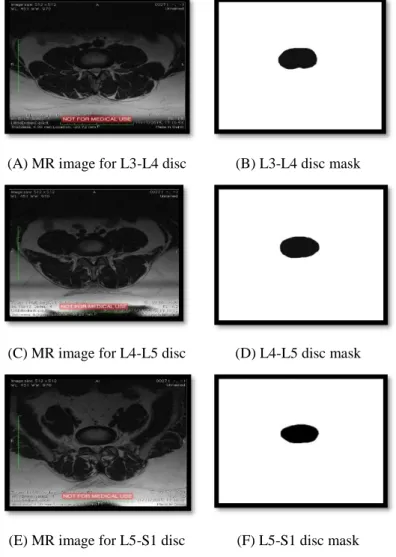 Figure 5.6: Discs MRI and the developed Mask for each disc. 