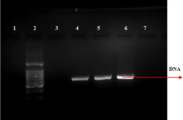 FIG  : 9     EXTRACTED  DNA  