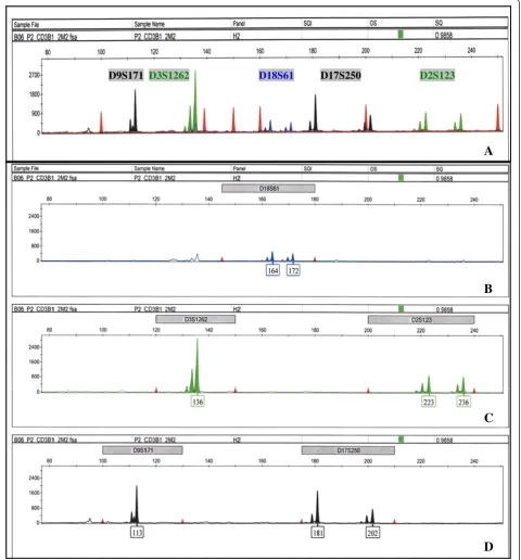 Figure 2 Electropherograms of group II markers. The x-axis represents DNA fragment size in base pairs, and the y-axis represents fluorescenceunits