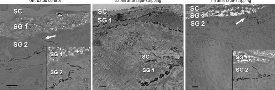 Fig. 1. Effect of acute permeability barrier disruption on the expression and localization of TJ proteins, Cldn-1 and Cldn-4 in murine epidermis
