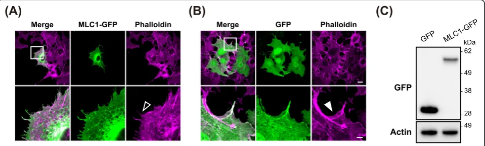Fig. 1 MLC1 induces morphological changes. COS-7 cells were transiently transfected with MLC1-GFP (a) or GFP (b), followed byimmunofluorescence staining with anti-GFP (green, transfection marker) antibody and phalloidin (magenta, fibrous actin)