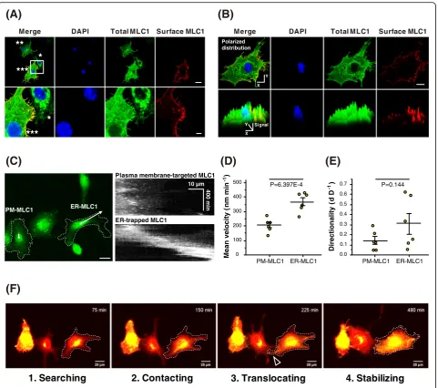 Fig. 4 Cellular morphology and motility are regulated by the subcellular localization of wildtype MLC1