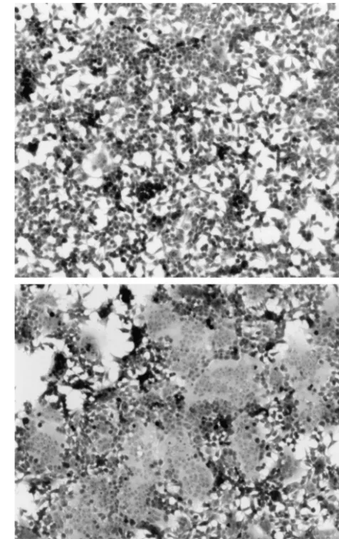 FIG. 2. Formation of syncytia in human cells by CAEV envelopeglycoprotein mutant P117D