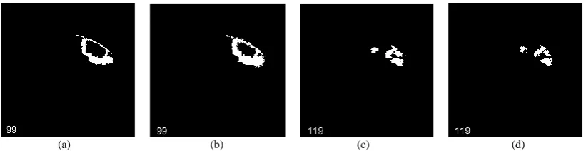 Figure 5. H06 image expert segmentation results and the segmentation results of the algorithm: (a) 99th sequence expert segmentation results.(b) 99th sequence algorithm segmentation results.(c) 119th sequence expert segmentation results