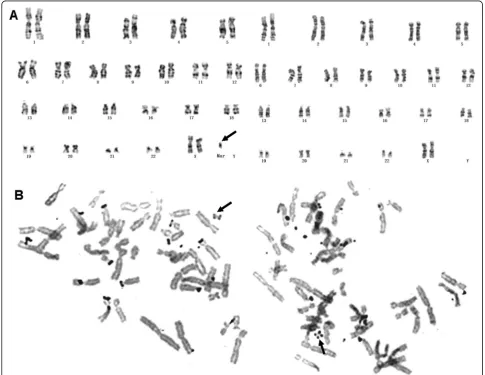 Fig. 6 Prenatal diagnosis of 47,XN,+mar [37]/46,XN [63] in Case#4. There is no abnormal detected by SNP-array (Data not shown)