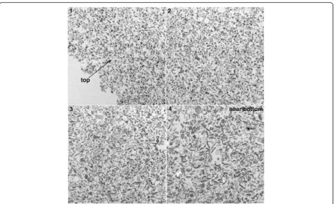 Fig. 2 Electron micrographs at low magnification show particle size gradient in pellets from sonicated samples: EM images (1–4) were taken at ~70 nm intervals from the top (1) to near bottom (4) of the pellet from a sonicated sample