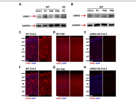 Fig. 1 Expression of LIMK1 and LIMK2 in developing mouse neocortex.sections, suggesting that the antibodies might be non-specific