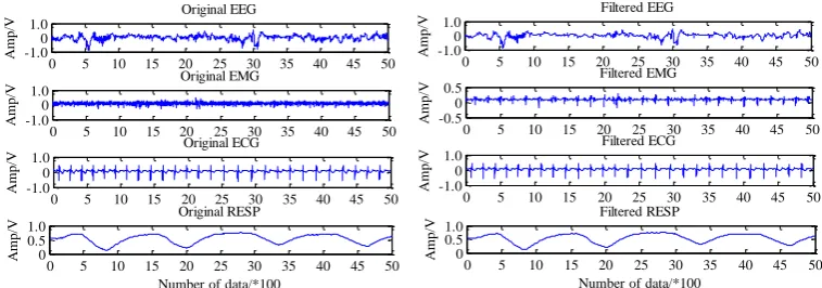 Figure 1. Denoising effect of EEG, EMG, ECG and Resp signals. 