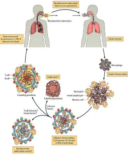 Fig. 2. Pathophysiology of M.Tuberculosis 