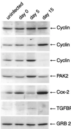 FIG. 2. Western blot analysis of extracts from JCV-infected astro-cytes for gene products of selected upregulated genes