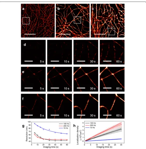 Fig. 3 | Characterization of the imaging speed of a new microscope. Super-resolution microtubule images of fixed COS-7 cells were used as amicroscope (an sCMOS camera, a band-pass filter, 460 W/cm5 um (model system